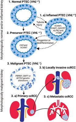 Cellular milieu in clear cell renal cell carcinoma